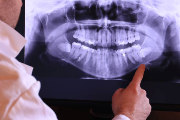 Best Emergency Denture Repair in Five Points, FL