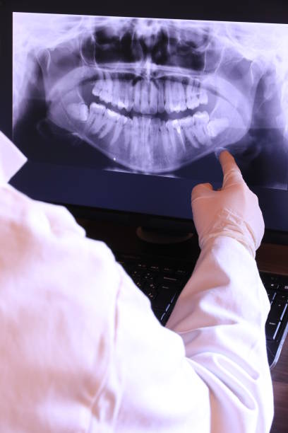 Best Emergency Dental Care for Broken or Chipped Teeth in Five Points, FL