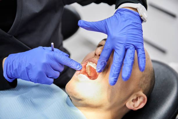 Best Emergency Wisdom Teeth Removal in Five Points, FL